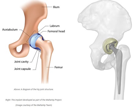 A diagram of the hip joint structure